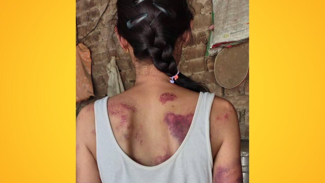 काळं-निळं पडेपर्यंत महिला वकिलाला मारलं, गुन्हाही दाखल नाही; यशोमती ठाकूरांचा गृहखात्यावर प्रहार