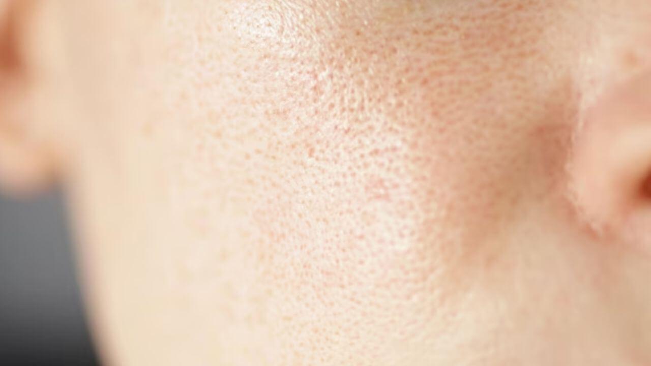 ओपन पोर्स वाढल्याने चेहरा खराब दिसतोय? मग ट्राय करा हे घरगुती उपाय