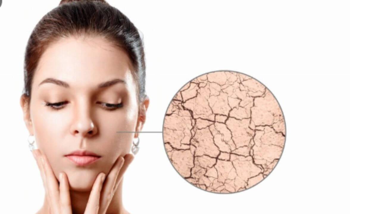 पावसाळ्यातसुद्धा त्वचा फारच कोरडी पडलीय? चमकदार त्वचेसाठी फॉलो करा ‘या’ टिप्स
