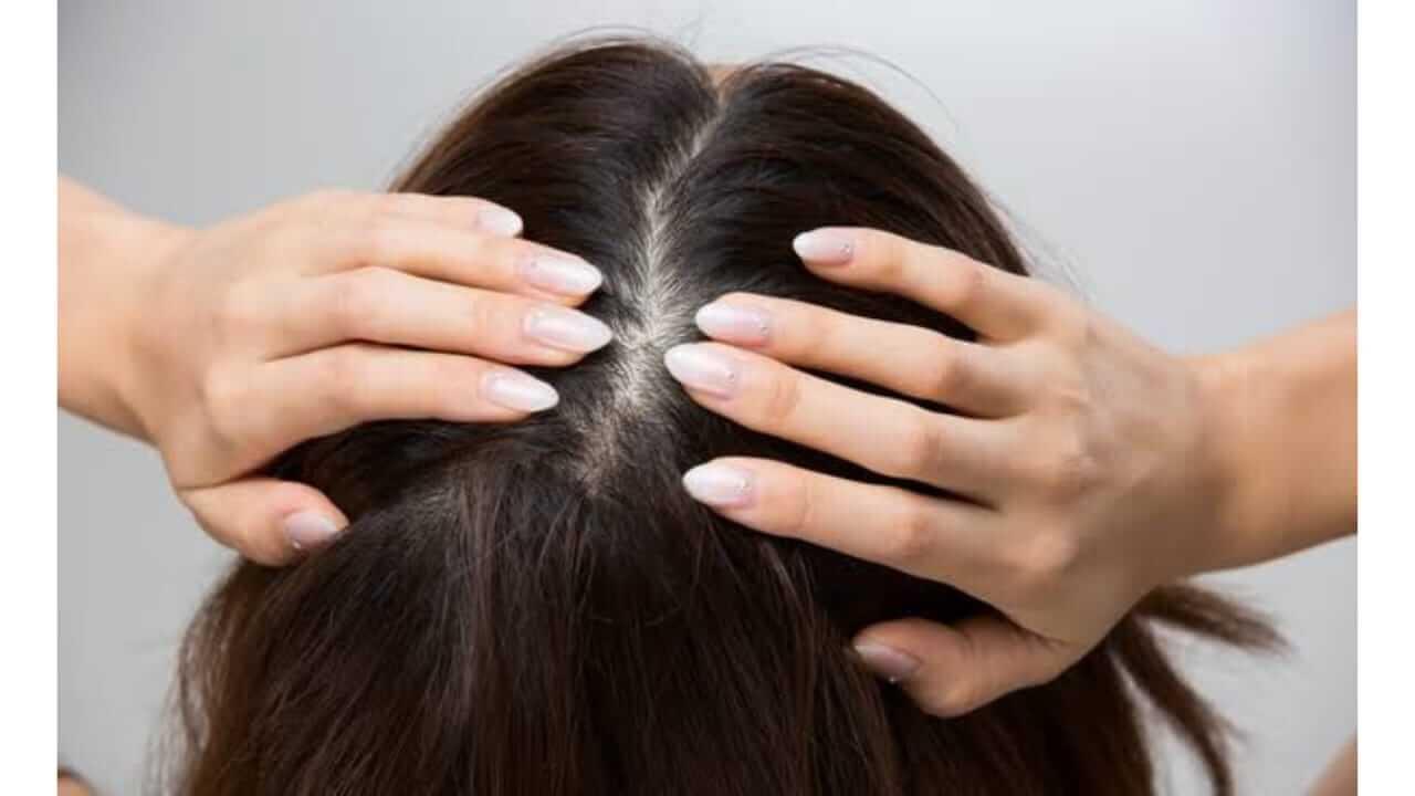 घामामुळे तुमच्या टाळूला खाज येते का? नारळाच्या तेलात ‘या’ गोष्टी मिसळा, लगेच आराम मिळेल