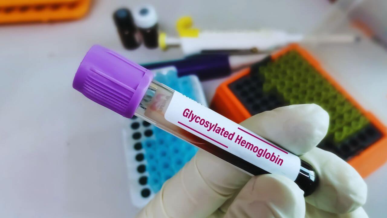 Hemoglobin : नैसर्गिकरित्या हिमोग्लोबीन वाढण्यास होईल मदत; डॉक्टरांनी सांगितलं काय आणि कसं खावं