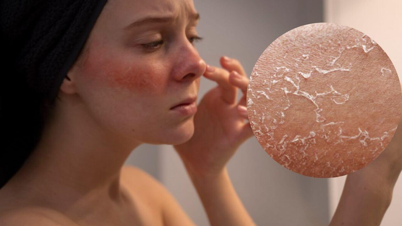 हिवाळा सुरु होण्याआधीच त्वचा कोरडी पडलीय? ‘हे’ घरगुती उपाय स्किन बनवतील एकदम मऊ आणि चमकदार