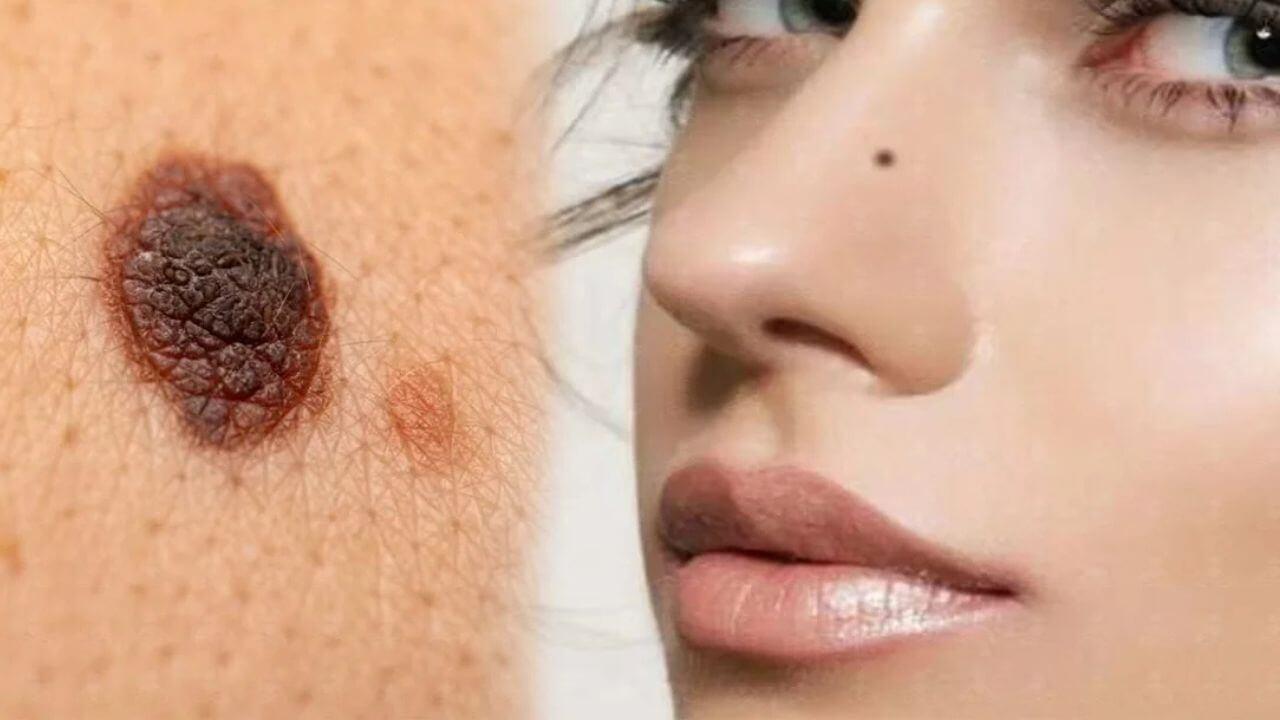 शरीराच्या या भागांवर तीळ आहे?? तुम्ही असणार भाग्यवान