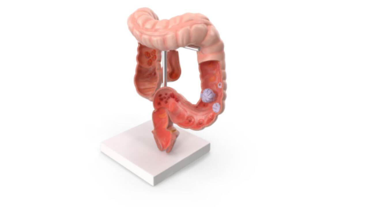 आतडे स्वच्छ आणि निरोगी ठेवायचे आहेत? मग ‘या’ सोप्या टिप्स फॉलो करा