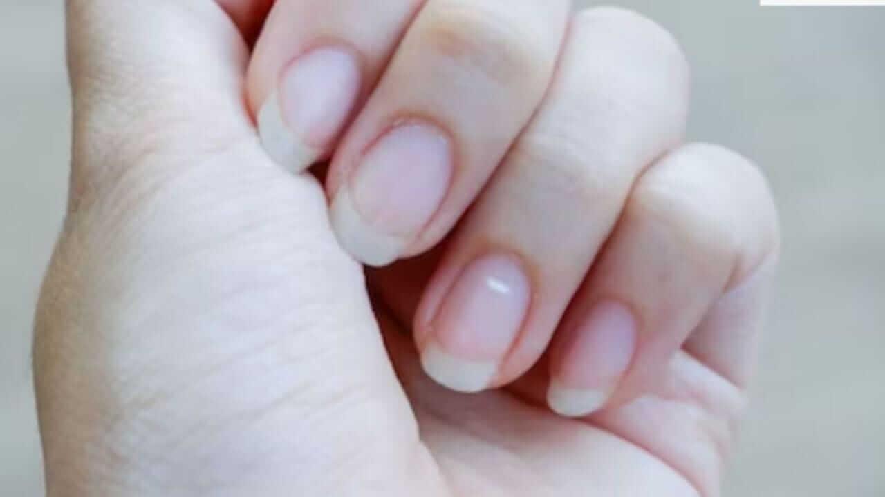 White Spots on Nails : नखांवरील पांढरे डाग देतात नशिबाचे संकेत वाचा काय सांगत शास्त्र…