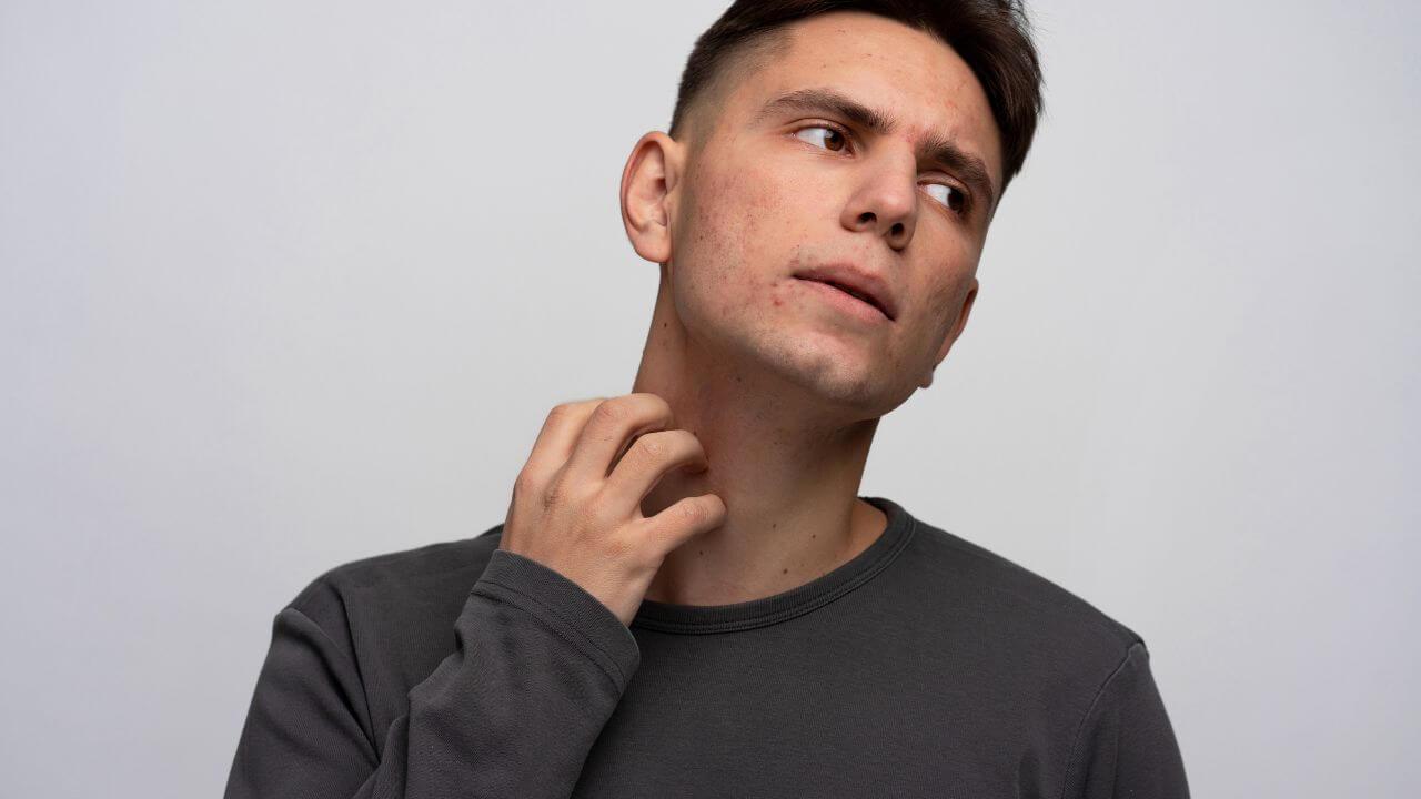 पित्तामुळे त्वचा कोरडी होऊन खाज सुटतेय? ‘हे’ आयुर्वेदिक उपाय देतील आराम