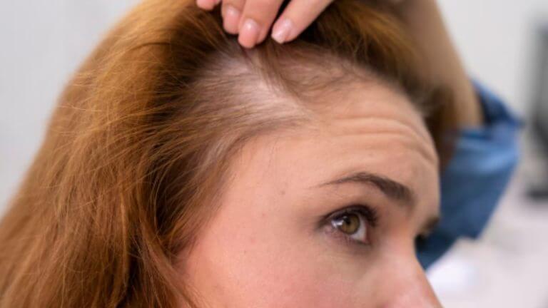 केस गळती थांबून लांबलचक होतील केस, फक्त करा ‘हे’ आयुर्वेदिक उपाय