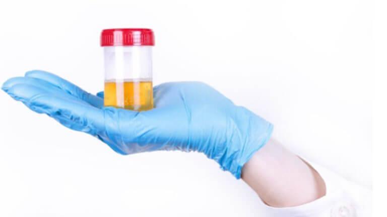 ‘या’ ४ पदार्थांमुळे बदलू शकतो लघवीचा रंग, चिंता करायची अजिबात गरज नाही