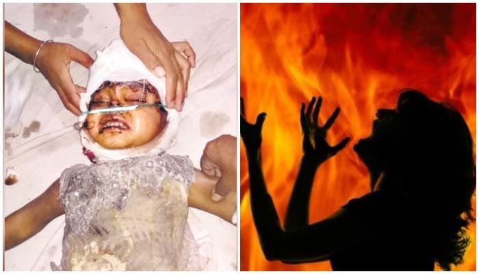 MP में 2 बड़ी वारदात: महिला के चेहरे पर केरोसिन डाल लगाई आग, इधर चलती ट्रेन से मासूम को फेंका