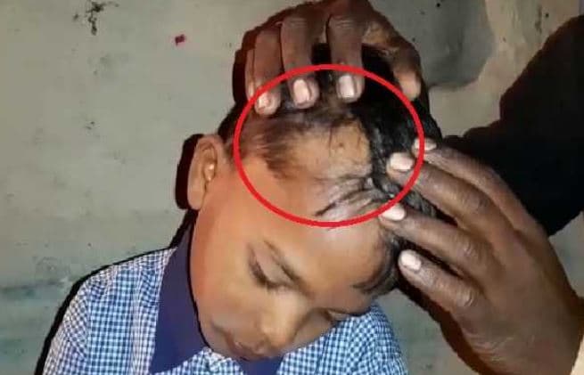 5वीं के छात्र पर भड़का शिक्षक, पहले बाल उखाड़े फिर दी अभद्र गालियां
