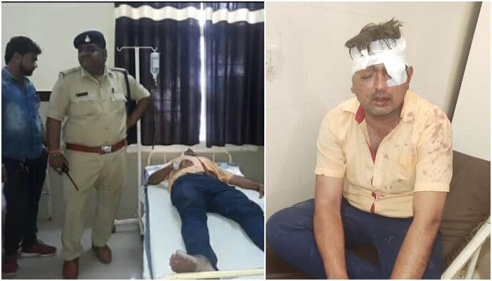 अब यहां आपस में भिड़े बीजेपी-कांग्रेस के कार्यकर्ता, जमकर हुई मारपीट, पार्षद घायल