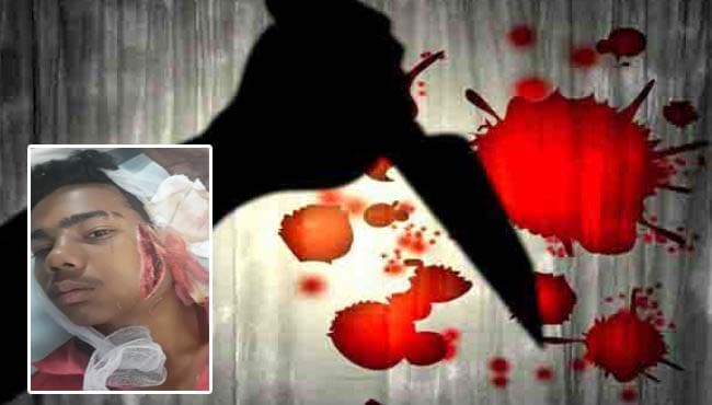 नाबालिग के चेहरे पर चाकू से हमला, घंटों तक पुलिस ने नहीं लिखी एफआईआर