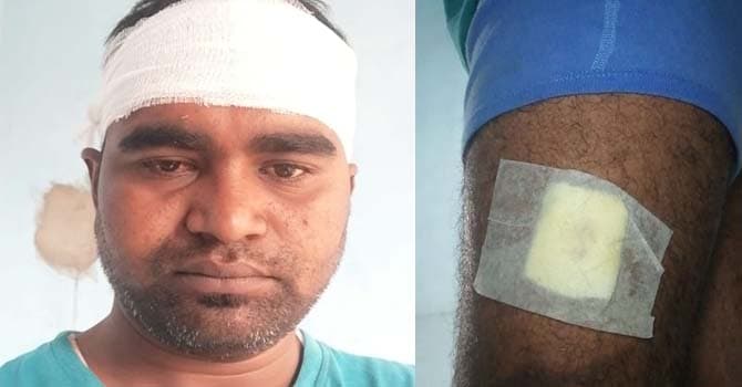 लूटपाट कर युवक को पेड़ से बांधकर भागे बदमाश, पुलिस मामले को दबाने में जुटी