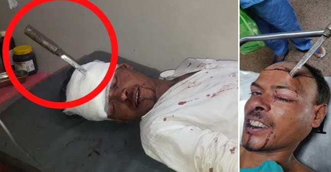 सिर में 4 इंच अंदर तक घुसा था चाकू, भोपाल के डॉक्टरों ने बचा ली जान
