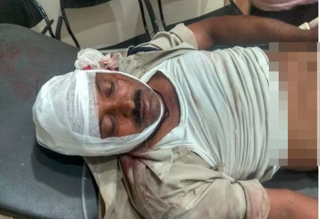 2 पक्षों में खूनी संघर्ष, पुलिसकर्मी समेत आधा दर्जन घायल, केंद्रीय मंत्री के बेटे पर मामला दर्ज
