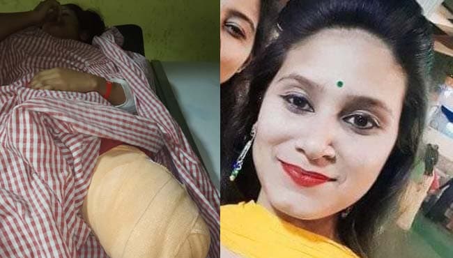 शराबी कार चालक ने तबाह की युवती की जिंदगी, पैर कटा, आरोपी गिरफ्त से दूर