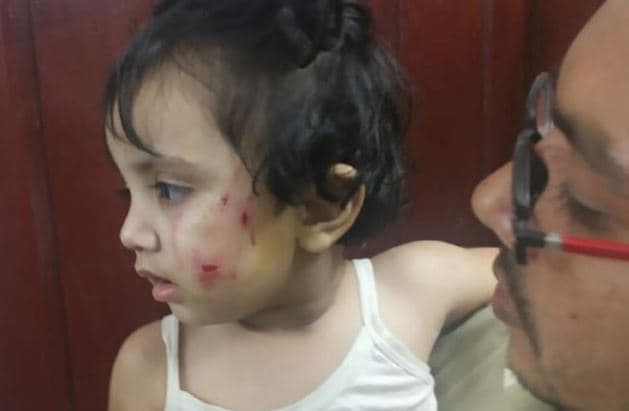 कुत्तों के खौफ से दहशत में राजधानी, ढाई साल की बच्ची को नोंचा, लोगों ने एक कुत्ते को मार डाला