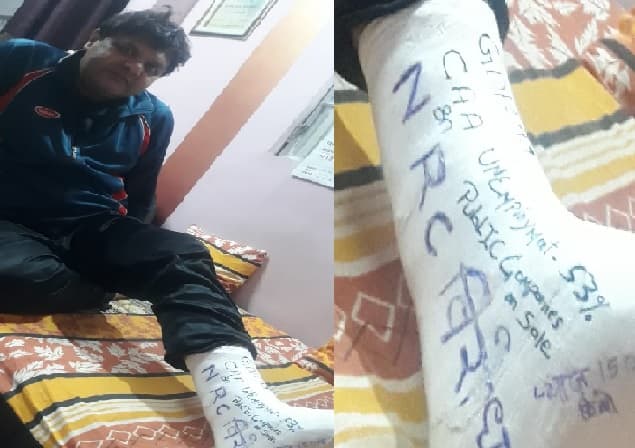 फ्रैक्चर पैर को बना लिया संदेश पटल, इस खास अंद़ाज में किया विरोध