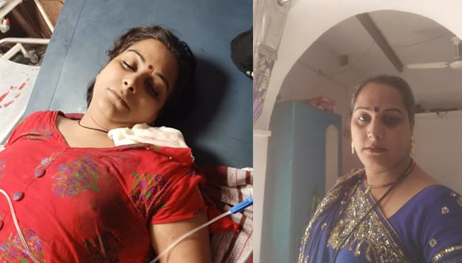 दिन दहाड़े नकाबपोश बदमाशों ने किन्नर को गोली मारी, तीन राउंड किये फायर