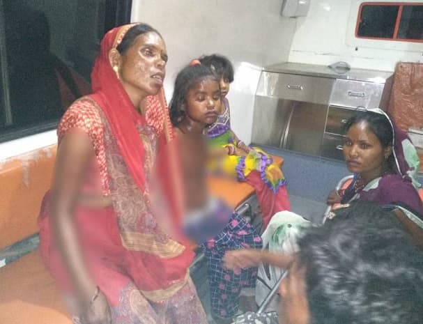 सागर: प्रेशर कुकर फटने से बच्चों सहित करीब 5 घायल