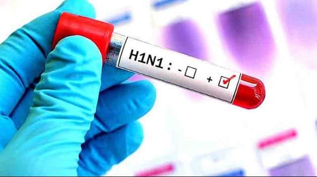 इन बीमारी वाले मरीजों को स्वाइन फ्लू है तो बचना मुश्किल!