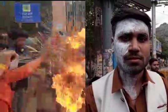 युवा कांग्रेस ने जलाया पीएम मोदी का पुतला, युवा कांग्रेस महासचिव झुलसा