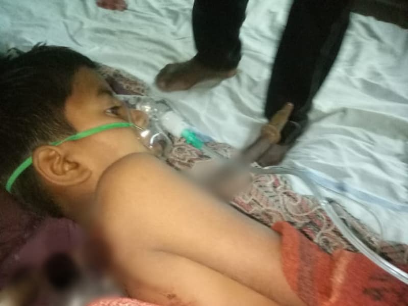 खेलते खेलते चारा काटने वाली मशीन पर गिरा मासूम, सीने से आर-पार हुई रॉड