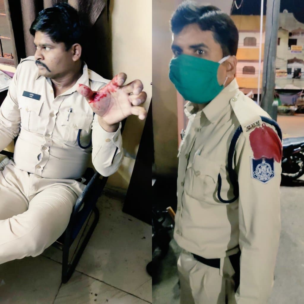शिवराज के ट्वीट के बाद एक्शन: पुलिस वालों पर हमले करने वाले गिरफ्तार, लगाई रासुका