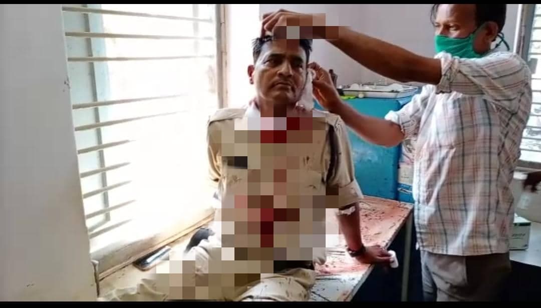 मास्क के लिये टोका तो सिरफिरे युवक ने दो पुलिसकर्मियों पर चाकू से किया हमला