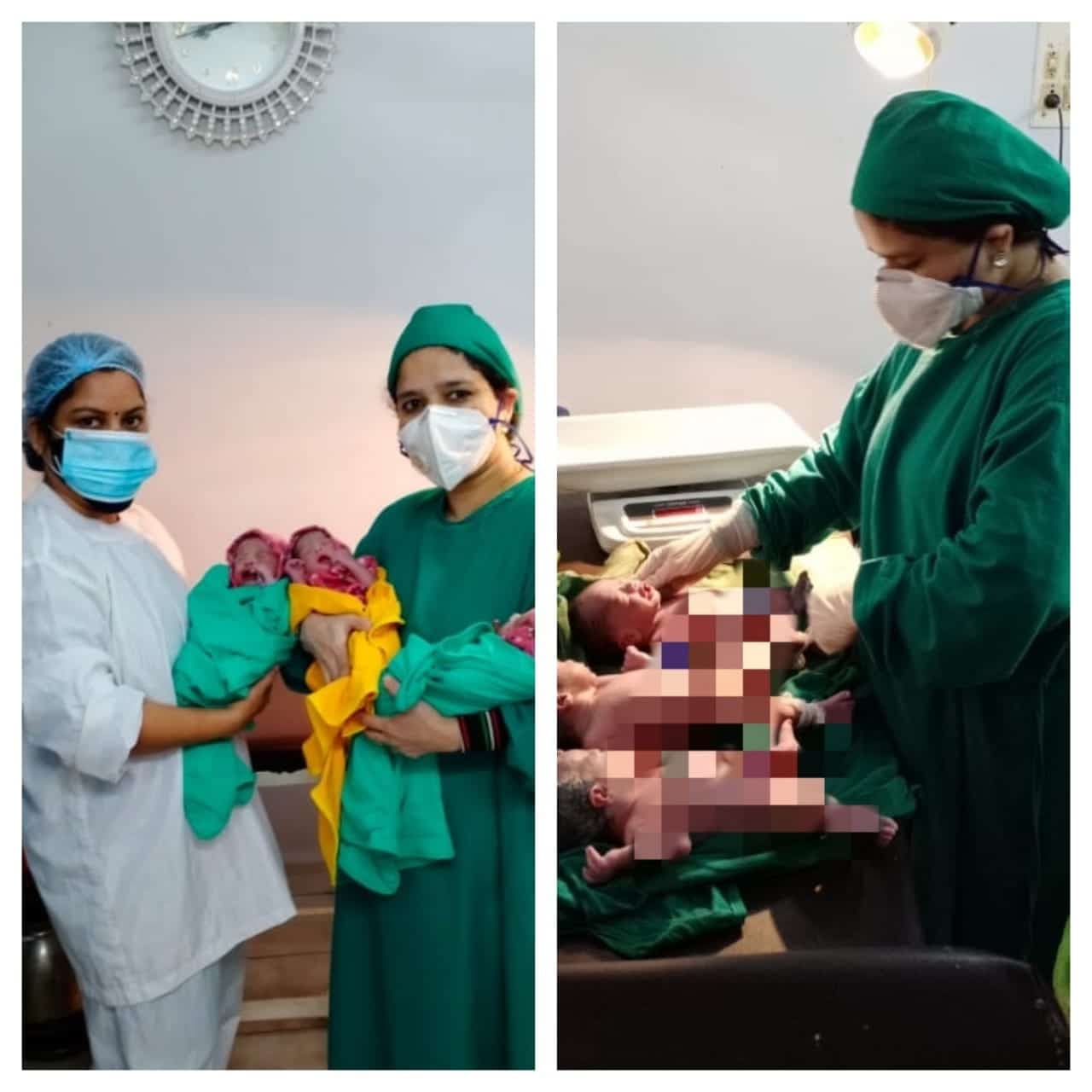 एक साथ 3 खुशियों की आमद, इंदौर में Triplets का जन्म, मां और बच्चे पूरी तरह स्वस्थ