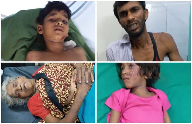 मकान की दीवार गिरी, 4 लोग घायल, अस्पताल में भर्ती