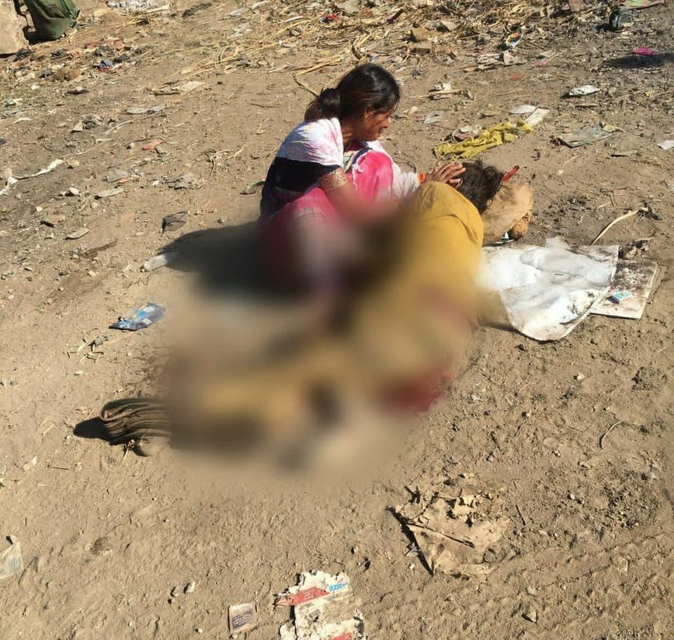 सड़क किनारे बैठे युवक पर चढ़ाया ट्रक,दोनों पैर बुरी तरह ज़ख्मी,ड्राइवर फरार