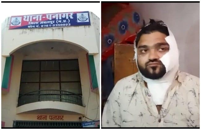 तेजाब काण्ड: पुरानी रंजिश में दो युवकों पर फेंका तेजाब, हमलावर पिता-पुत्र गिरफ्तार