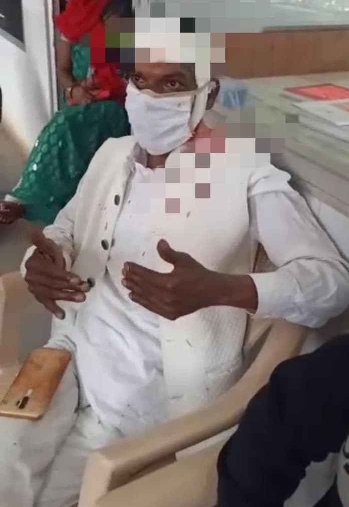 भाजपा नेता पर चाकूओं से हमला, नेता सहित तीन लोग घायल, हमलावर फरार