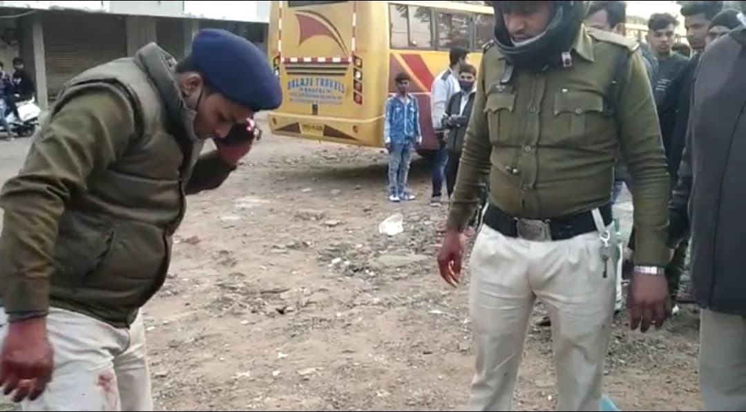 बदमाश की हथकड़ी थामे पुलिसकर्मी फुल्की खाने रूके, आरोपी ने ठेले से उठाकर अपनी गर्दन में मारा चाकू