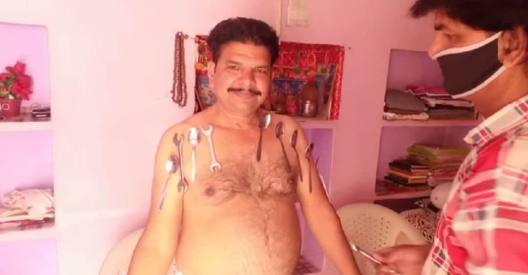 शिवपुरी: इंटरनेट पर देखा वीडियो , प्रयास किया तो शरीर से चिपकने लगे चम्मच से लेकर रिंच-पाना