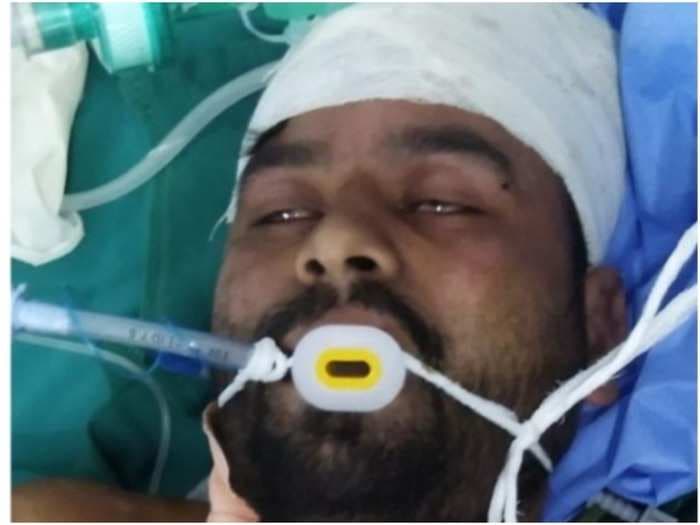 होशंगाबाद: सरपंच पति की अमानवीय करतूत! विवाद में हुई बेईज्जती तो बदले में काट डाले युवक के दोनों हाथ