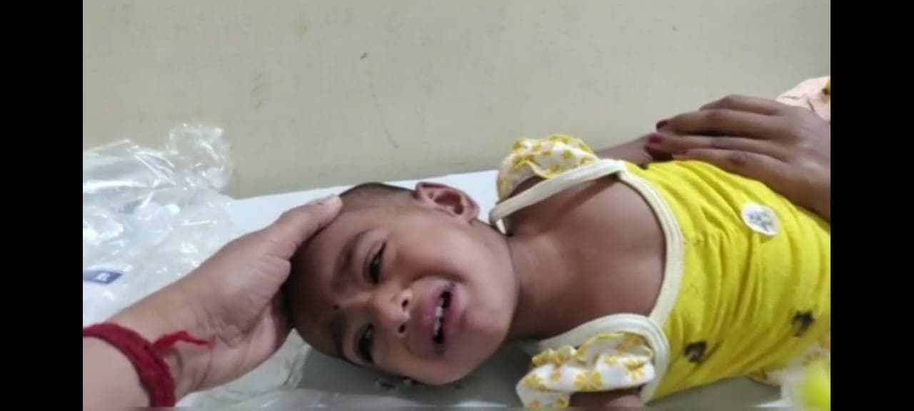 मिर्ची का टुकड़ा पड़ा मासूम की सांसों पर भारी, मुश्किल से बची जान