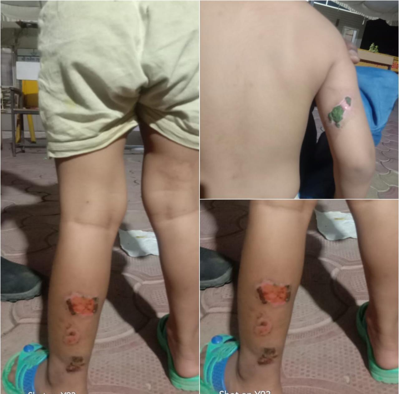 हैवानियत की हदें पार करने वाली माँ गिरफ्तार, मासूम बेटे को गर्म चाकू से दागकर ऐसे करती थी टॉर्चर