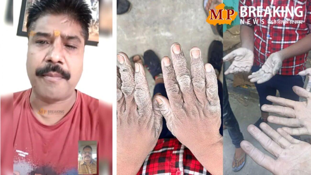 MP News : सोम डिस्टलरीज में बाल श्रम मामले में CWC अध्यक्ष अतुल दुबे ने किया बड़ा खुलासा, जानिए क्या कहा….