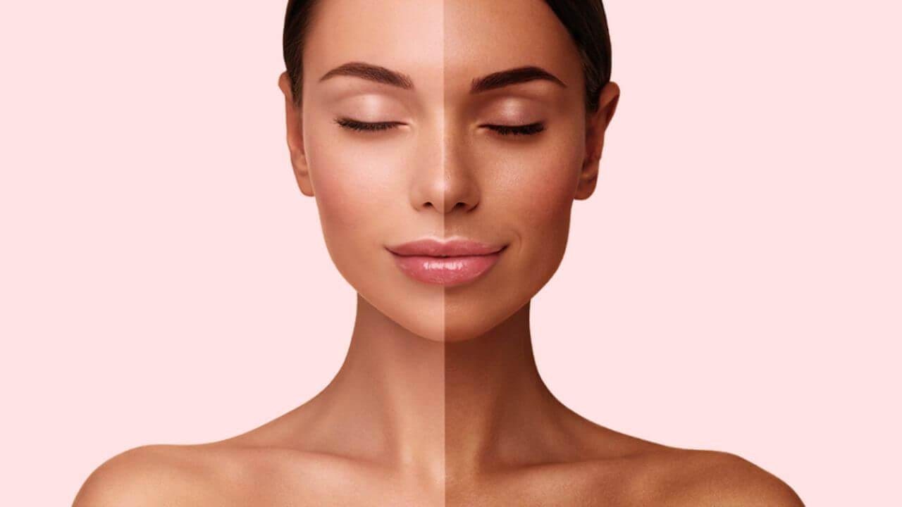 शादी में दिखना है खूबसूरत? पार्लर के खर्च से बचें, घर पर ऐसे करें De-Tan ट्रीटमेंट