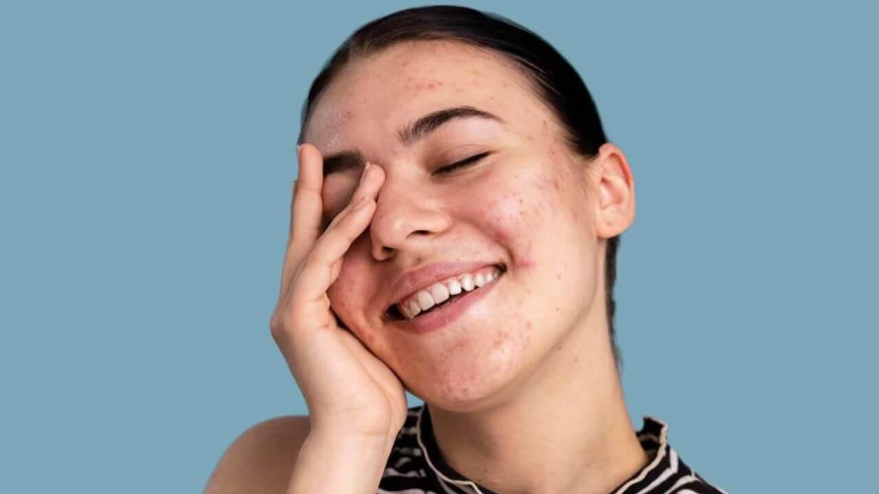 क्या आप भी ठंड में Skin Care से जुड़ी ये गलतियां कर रहे हैं? जानिए क्या पड़ेगा असर