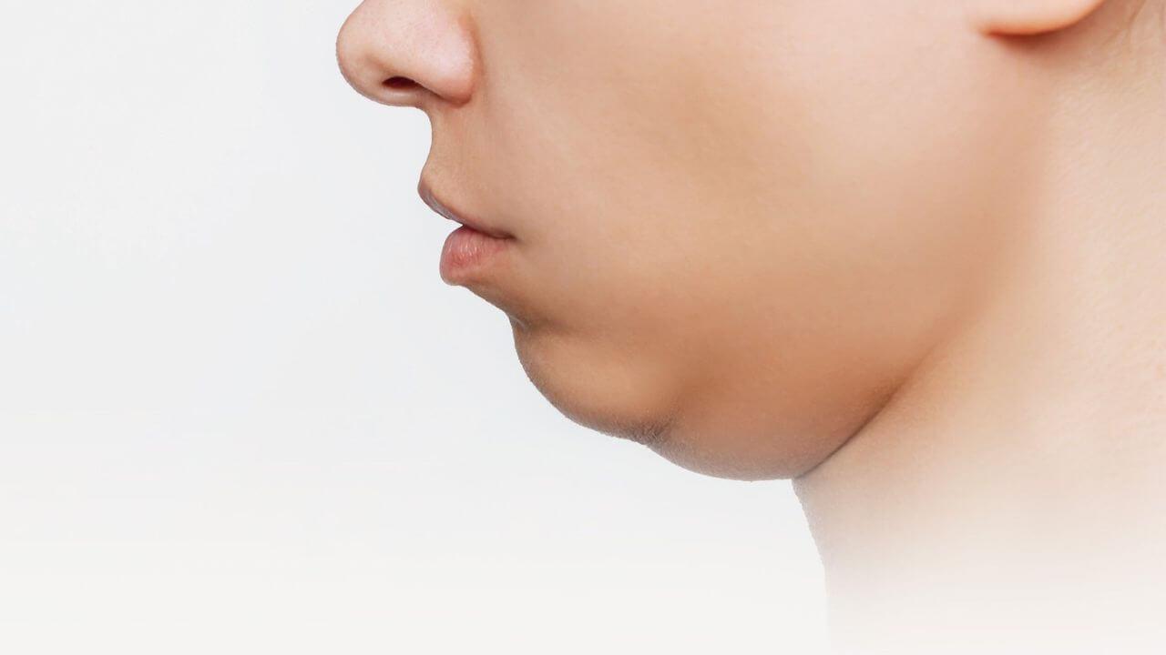 डबल चिन से थुलथुला दिख रहा है चेहरा, अपनाएं ये 6 आसान उपाय, स्किन दिखने लगेगा सुंदर