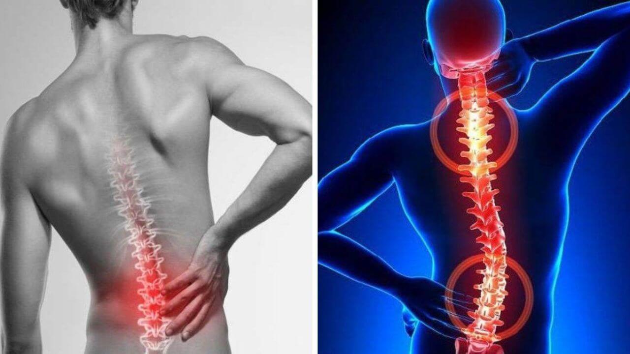 कमर दर्द को न करें नजरअंदाज, जानिए इसके लक्षण और बचाव के उपाय