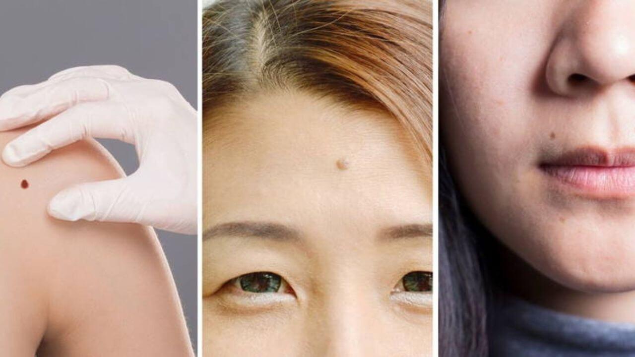 Personality Test: शरीर के अंगों पर मौजूद तिल खोलेंगे व्यक्तित्व के राज, उजागर होंगे छुपे हुए गुण