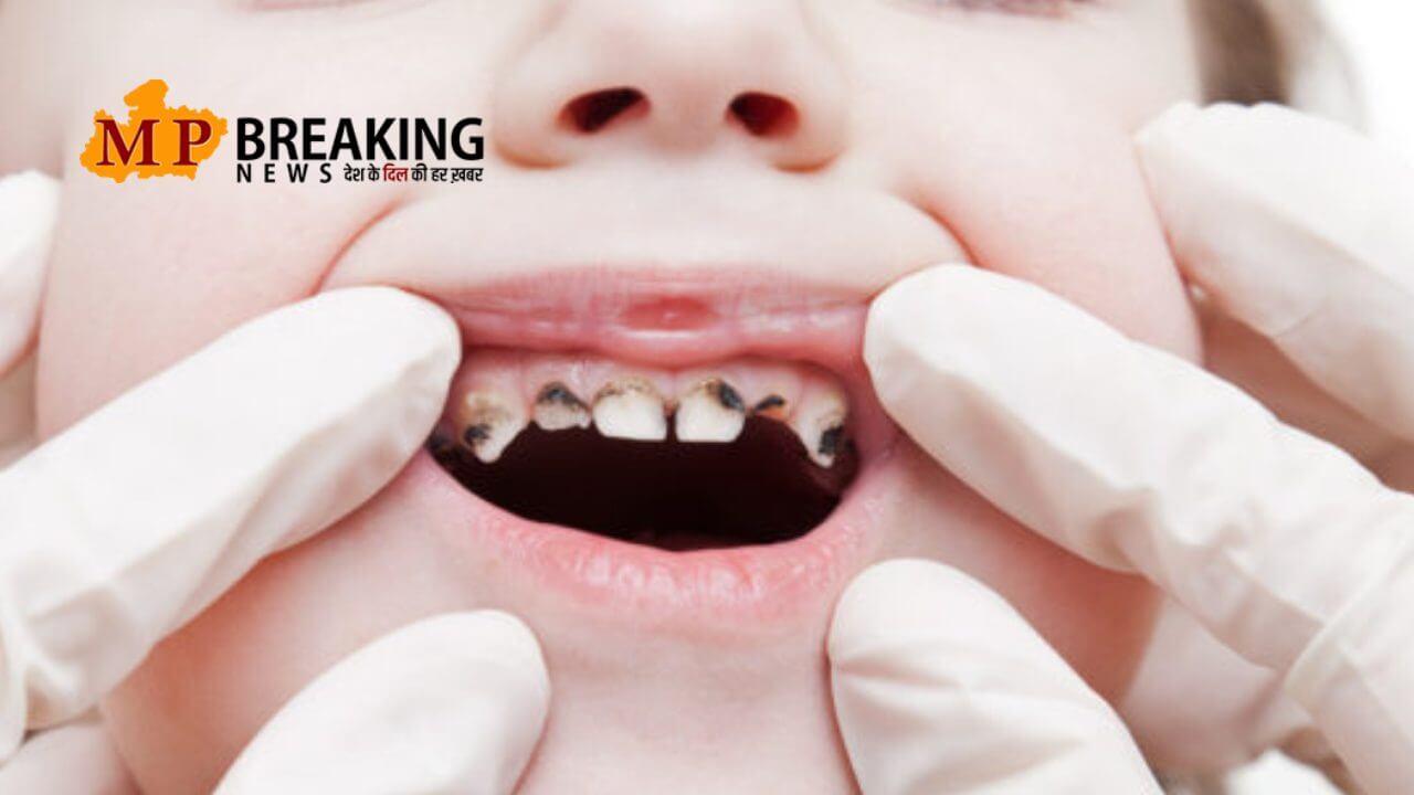 गर्मियों में ड्राय माउथ और दाँतों की सड़न से परेशान है?, कैविटी से बचने के लिए अपनाएँ ये आसान हेल्थ टिप्स!