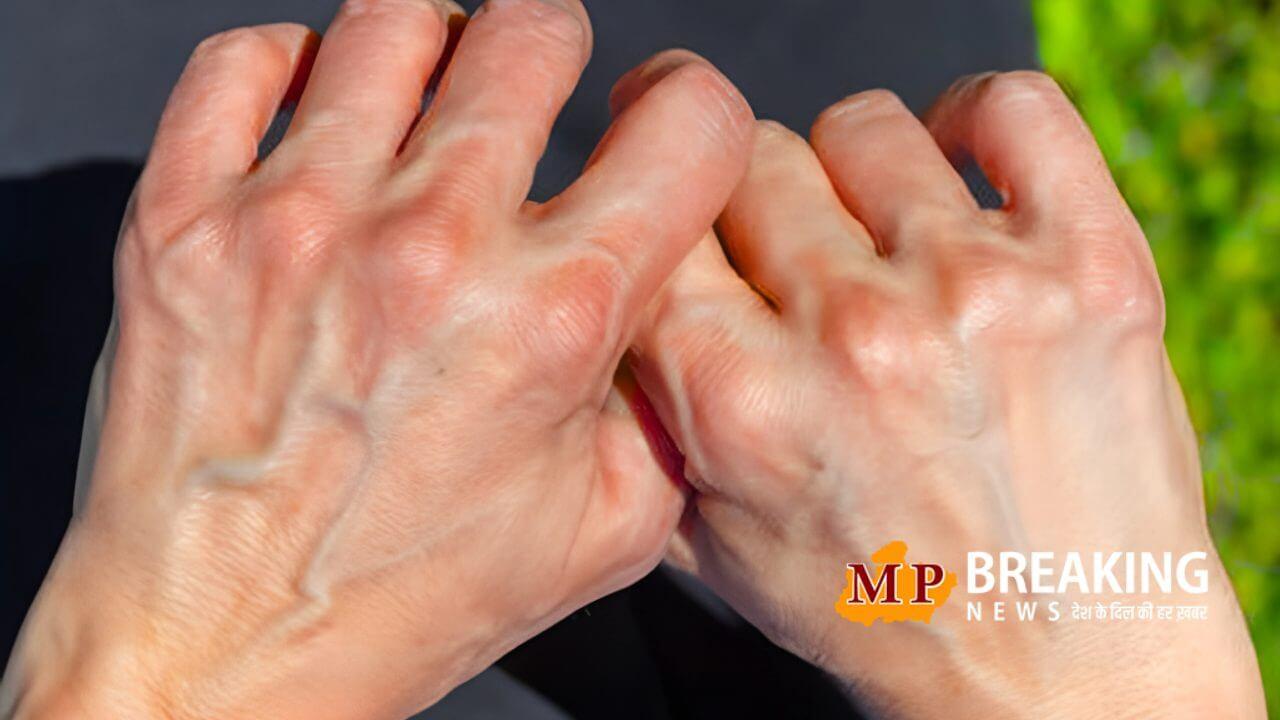 नसें नीली-हरी क्यों दिखती हैं?, आइये जानते, हमारी बॉडी के इंट्रेस्टिंग साइंस को और समझते ऐसा किस लिए होता है