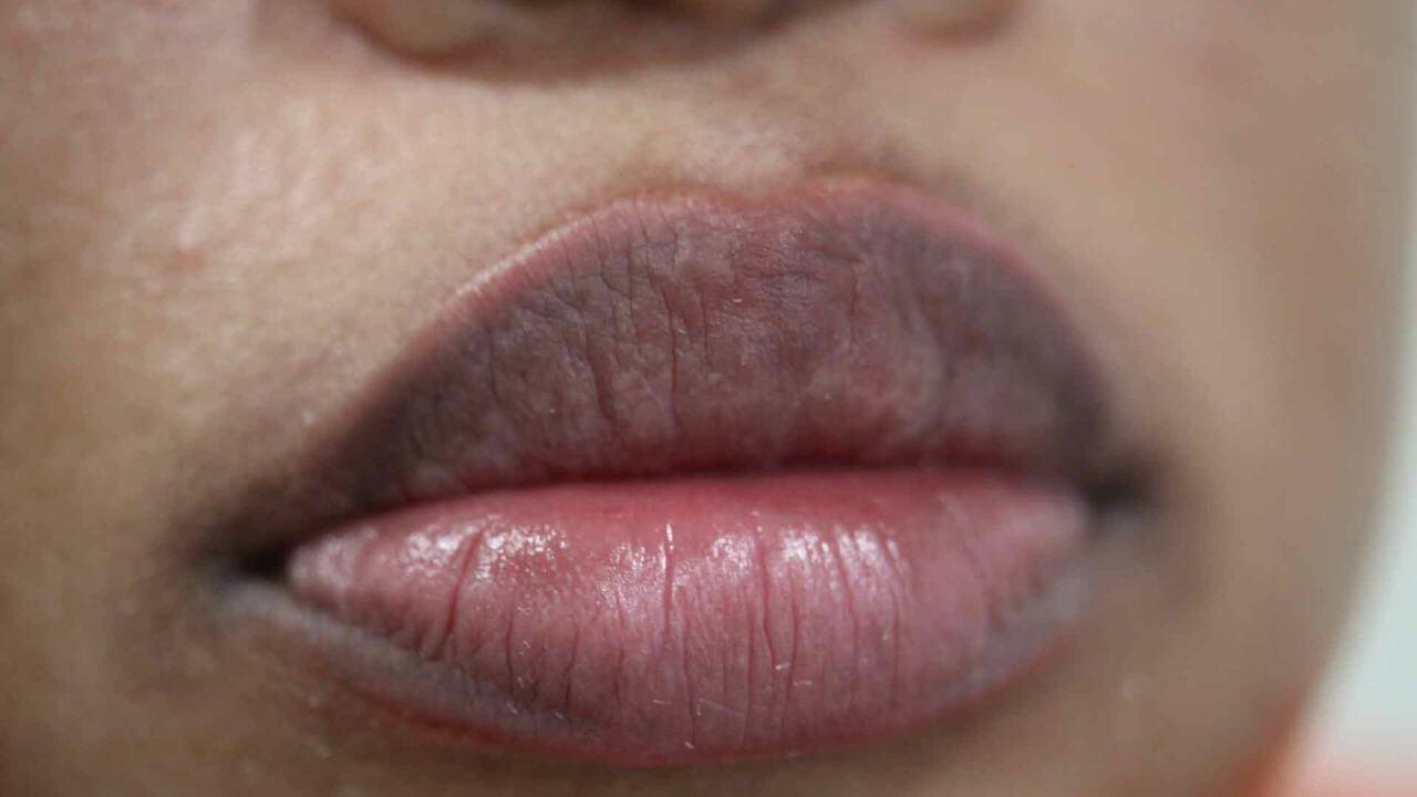 होंठों के चारों तरफ कालापन क्यों हो रहा है? घर पर अपनाएं ये 5 बेहतरीन टिप्स