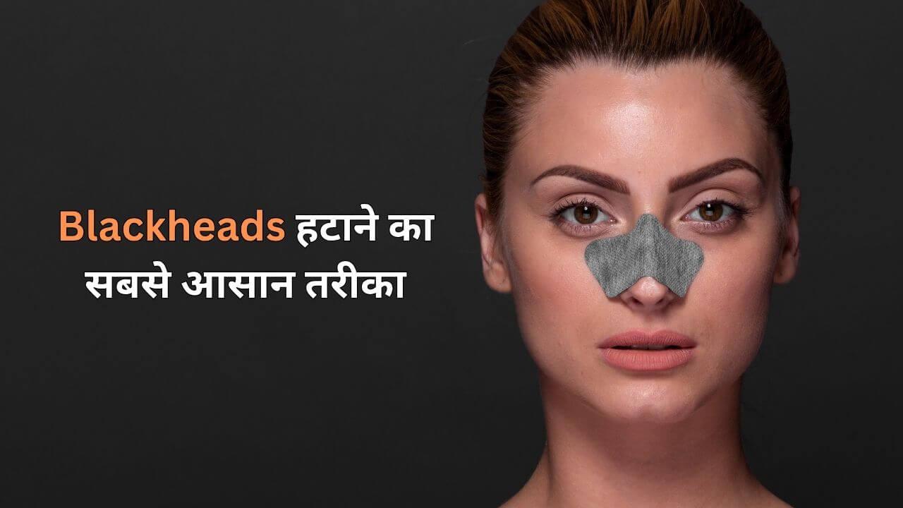 Blackheads हटाने का सबसे आसान तरीका, बिना महंगे प्रोडक्ट्स के, मिनटों में असर