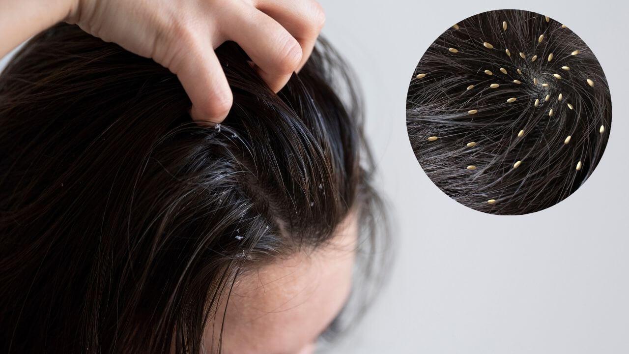 हेयर ग्रोथ की रफ्तार चाहिए दोगुनी, अपनाएं ये घरेलू नुस्खे, बाल हो जाएंगे चमकदार और खूबसूरत